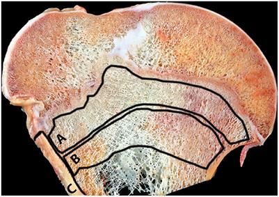 Bone quality changes as measured by Raman and FTIR spectroscopy in primiparous cows with humeral fracture from New Zealand